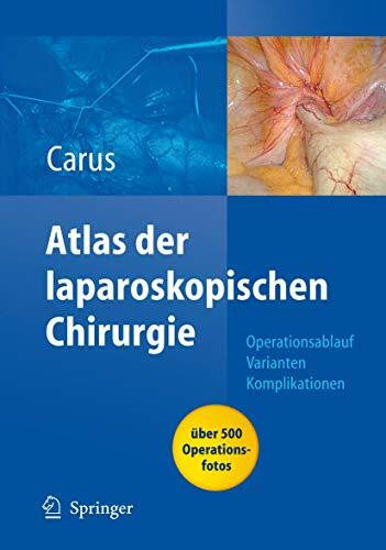 Operationsatlas Laparoskopische Chirurgie: Indikationen - Operationsablauf - Varianten - Komplikationen Mit Single Access Surgery