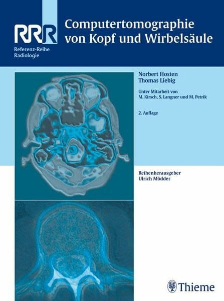 Computertomographie von Kopf und Wirbelsäule: . Zus.-Arb.: Norbert Hosten, Thomas Liebig Geleitwort von Roland Felix 420 teils farbige Abbildungen in ... ... (Referenz-Reihe Radiologie)