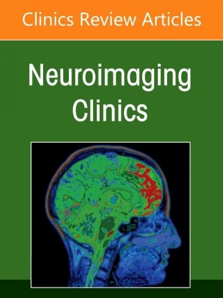 Management and Treatment of Cerebral Aneurysms, An Issue of Neuroimaging Clinics of North America (Volume 35-3) (The Clinics: Radiology, Volume 35-3)