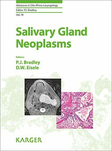 Salivary Gland Neoplasms (Advances in Oto-Rhino-Laryngology, Band 78)