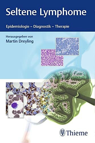 Seltene Lymphome: Epidemiologie, Diagnostik, Therapie