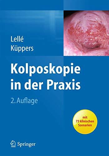 Kolposkopie in der Praxis: Mit 73 klinischen Szenarien