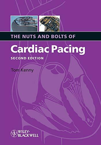 The Nuts and Bolts of Cardiac Pacing (Nuts and Bolts Series (Replaced by 5113)) The Nuts and Bolts of Cardiac Pacing (Nuts and Bolts Series (Replaced by 5113))