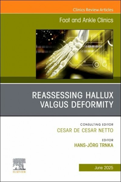 Reassessing Hallux Valgus Deformity, An Issue of Foot and Ankle Clinics of North America (Volume 30-2) (The Clinics: Orthopedics, Volume 30-2)