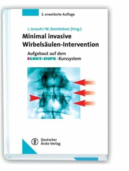 Minimal-Invasive Wirbelsäulen-Intervention 2. Auflage: Aktuelle und innovative Verfahren für Praxis und Klinik Aufgebaut auf dem IGOST-IMPS-Kurssystem