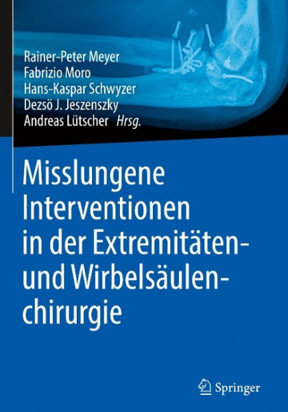 Misslungene Interventionen in der Extremitäten- und Wirbelsäulenchirurgie