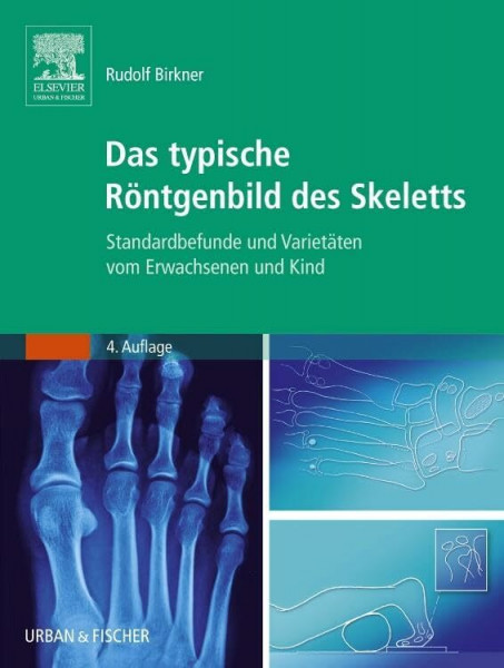 Das typische Röntgenbild des Skeletts: Standardbefunde und Varietäten vom Erwachsenen und Kind