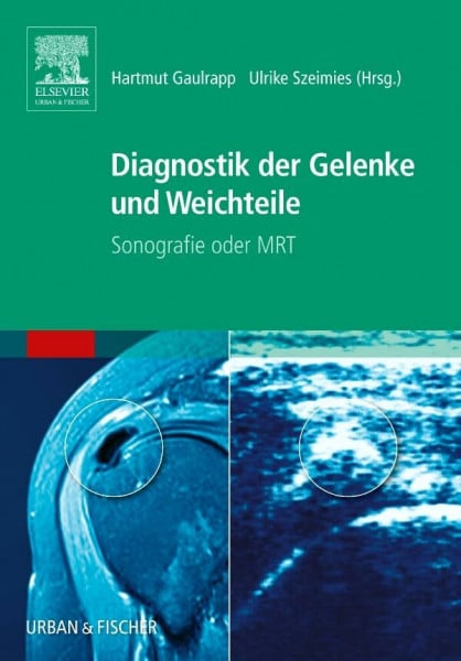 Diagnostik der Gelenke und Weichteile: Sonografie oder MRT