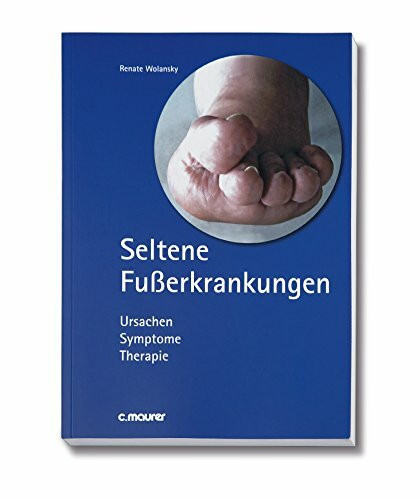 Seltene Fußerkrankungen: Ursache Symptome Therapie