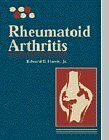 Rheumatoid Arthritis