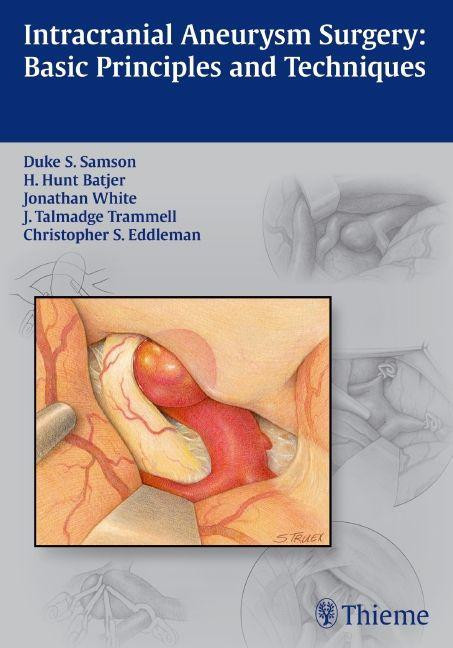 Intracranial Aneurysm Surgery - Samson, Duke S.