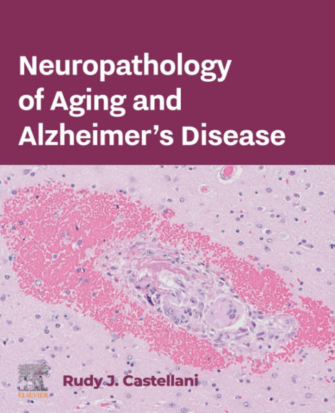Neuropathology of Aging and Alzheimer’s Disease