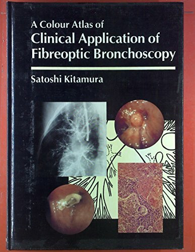 Clinical Application of Fibre Optic Bronchoscopy