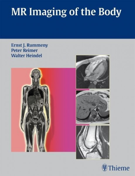 Whole Body MRI Imaging