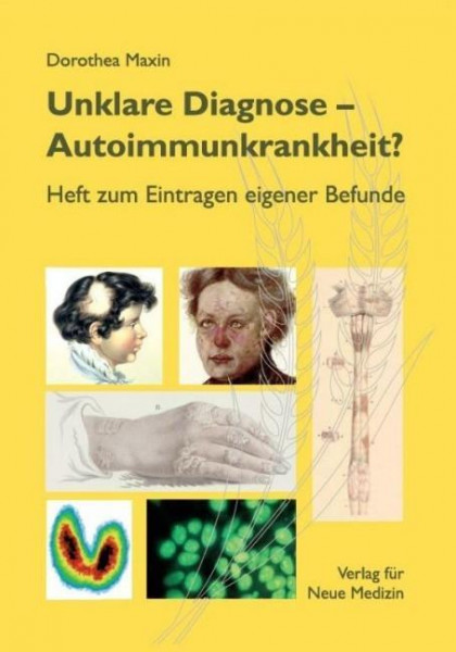 Unklare Diagnose: Autoimmunkrankheit?