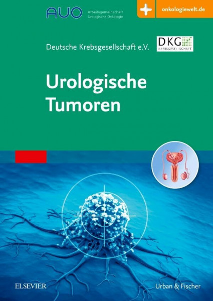 Urologische Tumoren: mit Zugang zur Medizinwelt