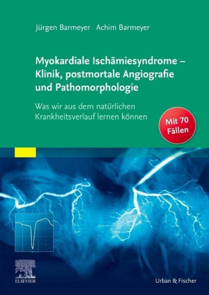 Myokardiale Ischämiesyndrome - Klinik, postmortale Angiografie und Pathomorphologie