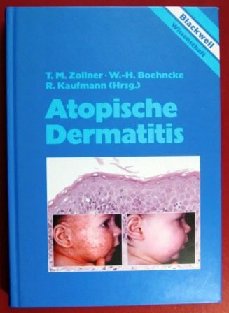 Atopische Dermatitis.