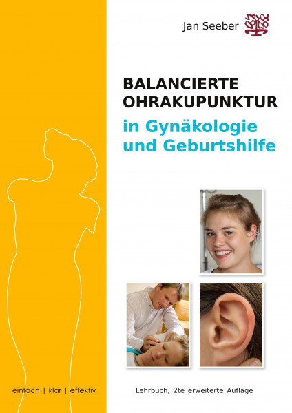 Ohrakupunktur in Gynäkologie und Geburtshilfe