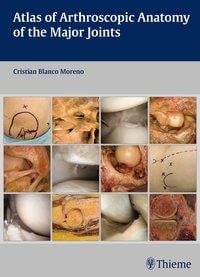 Atlas of Arthroscopic Anatomy of Major Joints