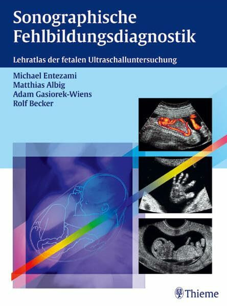 Sonographische Fehlbildungsdiagnostik: Lehratlas der fetalen Ultraschalluntersuchung