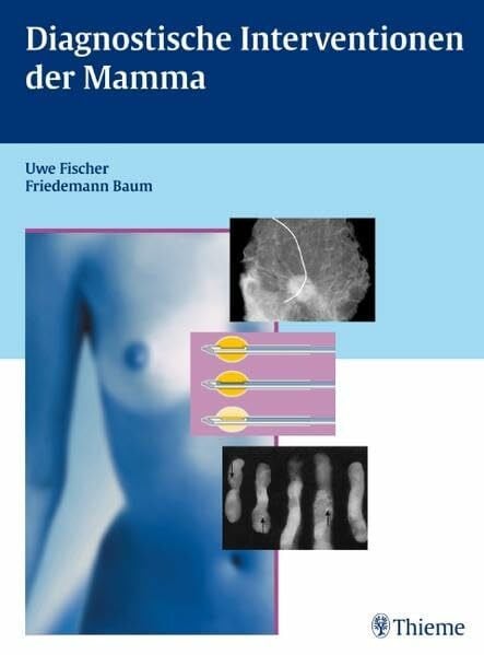 Diagnostische Interventionen der Mamma