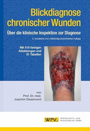 Blickdiagnose chronischer Wunden: Über die klinische Inspektion zur Diagnose