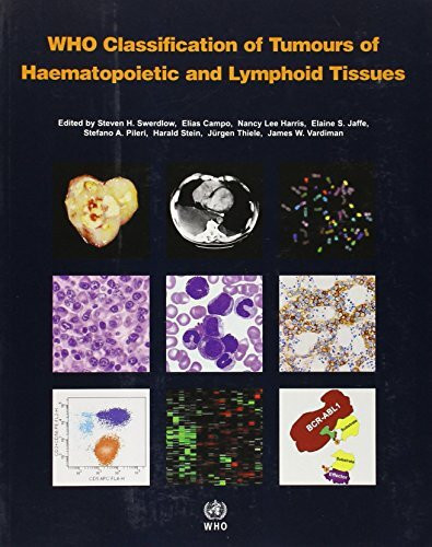 WHO Classification of Tumours of Haematopoietic and Lymphoid Tissues: Vol. 2: International Agency for Research on Cancer