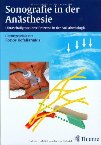 Sonografie (sic!) in der Anästhesie: Ultraschallgesteuerte Prozesse in der Anästhesiologie