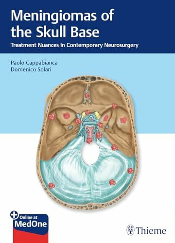 Meningiomas of the Skull Base: Treatment Nuances in Contemporary Neurosurgery. Plus Online at MedOne