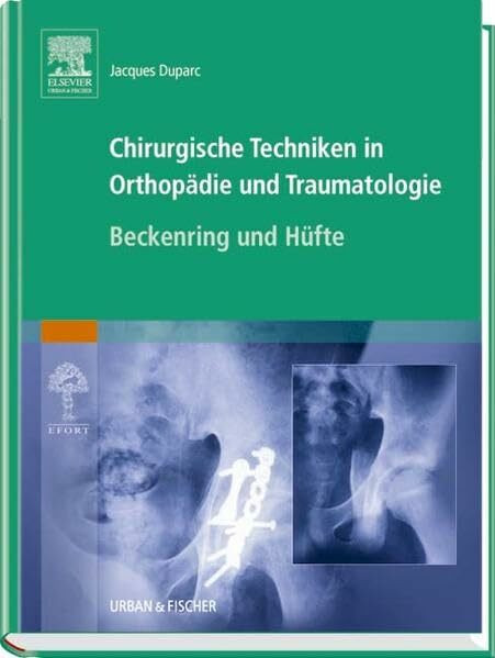 Chirurgische Techniken in Orthopädie und Traumatologie 8 Bände: Chirurgische Techniken in Orthopädie und Traumatologie: Beckenring und Hüfte