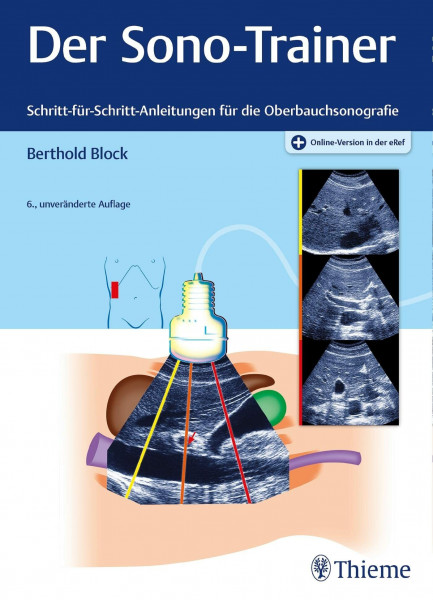 Der Sono-Trainer: Schritt-für-Schritt-Anleitungen für die Oberbauchsonografie