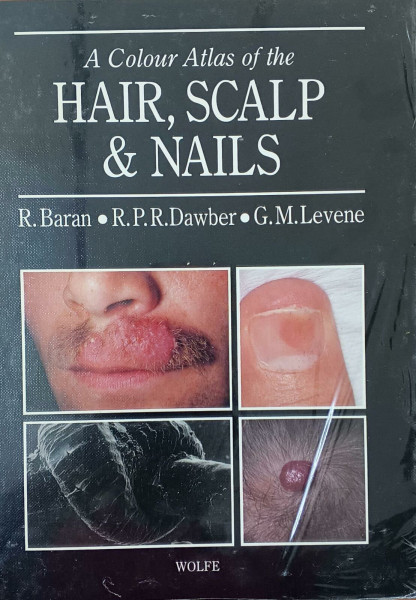 A Colour Atlas of the Hair, Scalp and Nails