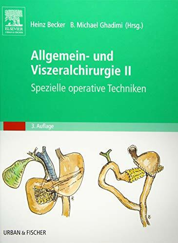 Allgemein- und Viszeralchirurgie II - Spezielle operative Techniken- (Becker, Set Allgemein- und Viszeralchirurgie)