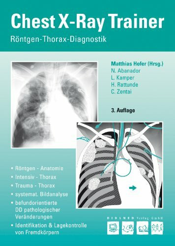 Chest-X-Ray-Trainer: Röntgen-Thorax-Diagnostik