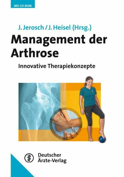 Management der Arthrose: Neue therapeutische Konzepte