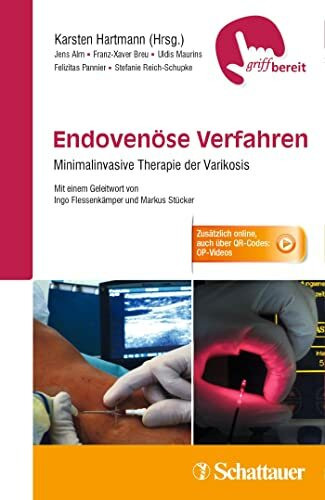 Endovenöse Verfahren: Minimalinvasive Therapie der Varikosis - griffbereit - Zusätzlich online, auch über QR-Codes: 11 OP-Videos