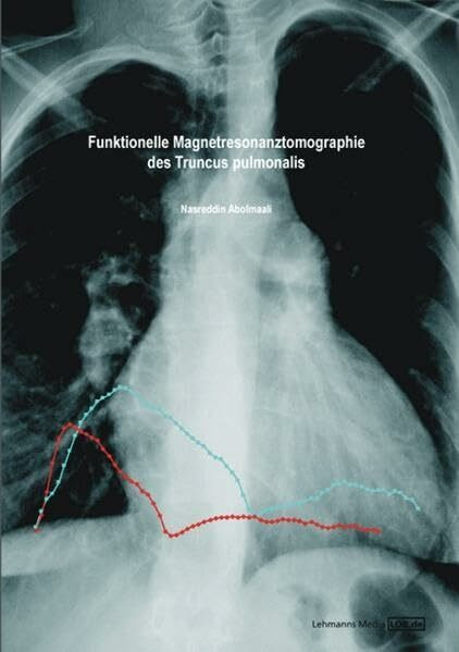 Funktionelle Magnetresonanztomographie des Truncus pulmonalis: Grundlagen der magnetresonanztomographischen Flussmessung zur Diagnostik der pulmonalen Hypertension