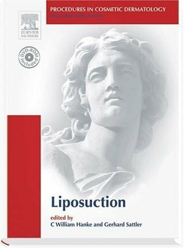 Liposuction (Procedures in Cosmetic Dermatology): Procedures in Cosmetic Dermatology Series