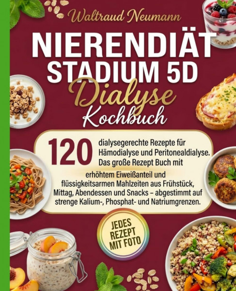 Nierendiät Stadium 5D – Dialyse Kochbuch: 120 dialysegerechte Rezepte für Hämodialyse und Peritonealdialyse. Mit erhöhtem Eiweißanteil und flüssigkeitsarmen Mahlzeiten.