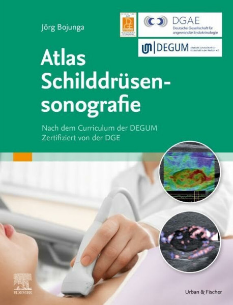 Atlas Schilddrüsensonografie: Nach dem Curriculum der DGUM. Zertifiziert von der DGE