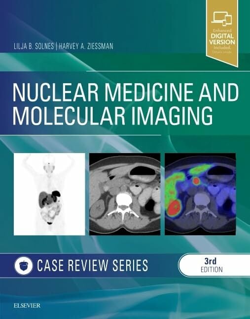Nuclear Medicine and Molecular Imaging: Case Review Series Nuclear Medicine and Molecular Imaging: Case Review Series