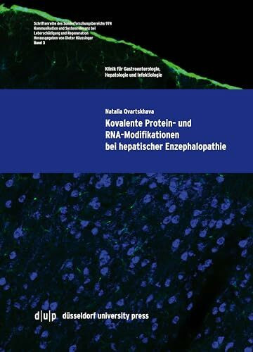 Kovalente Protein- und RNA-Modifikationen bei hepatischer Enzephalopathie (Schriftenreihe des Sonderforschungsbereich 974, 3, Band 3)
