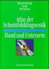 Atlas der Schnittbilddiagnostik Hand und Unterarm