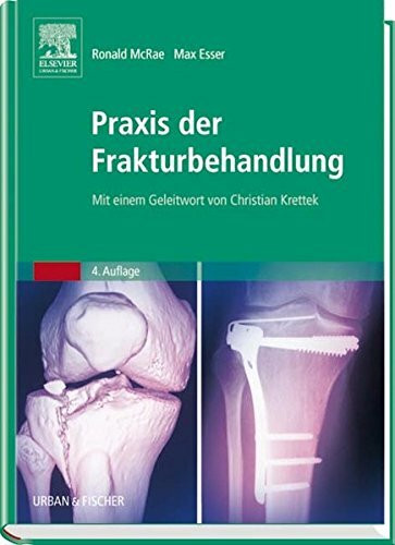 Praxis der Frakturbehandlung: Mit einem Geleitwort von Christian Krettek