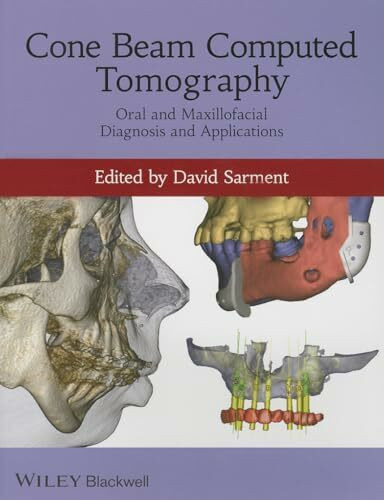 Cone Beam Computed Tomography: Oral and Maxillofacial Diagnosis and Applications