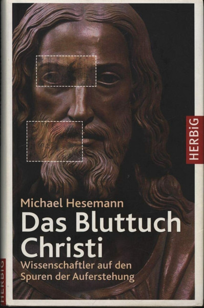 Das Bluttuch: Wissenschaftler auf den Spuren der Auferstehung