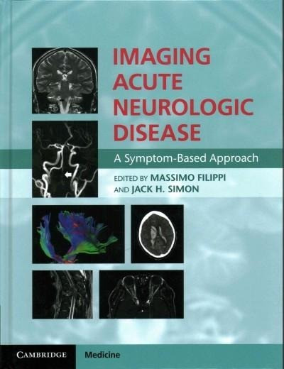 Imaging Acute Neurologic Disease: A Symptom-Based Approach