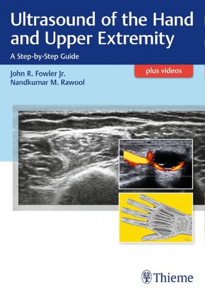 Ultrasound of the Hand and Upper Extremity