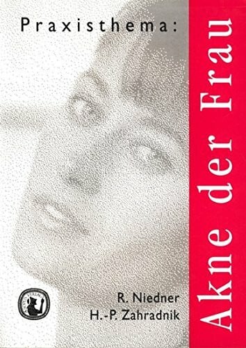 Akne der Frau